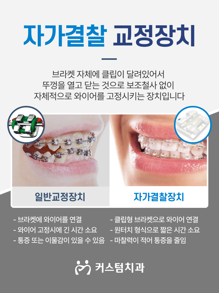 신중동역치과 심미적인 부분이 걱정된다면