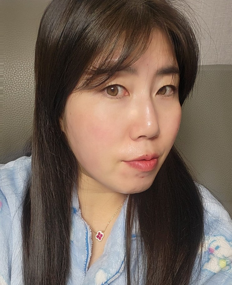  [해운대]부산 해운대 인모드 지방분해주사로 이중턱 뿌시기!!