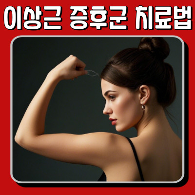 이상근 증후군 완벽 정리! 원인부터 치료법까지 총정리