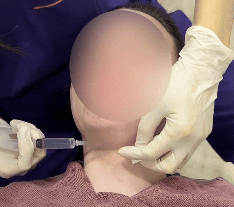  얼굴 보정 어플없이 사진 잘 나오는 방법 (이중턱살, 얼굴살 제거)