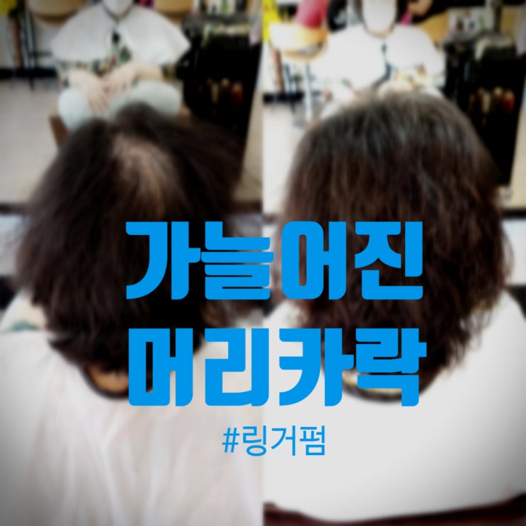  50대 모발이 가늘어졌다면? 풍성한 볼륨을 위한 링거펌 추천