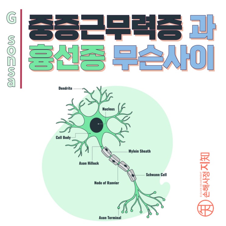  중증근무력증과 흉선종 - 면역체계의 오작동이 만드는 숨겨진 연결고리 - [질병정보, Why]