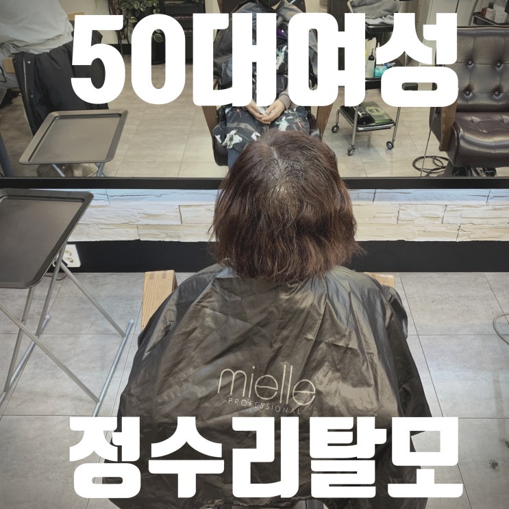  50대여자 볼륨 없고 휑한 정수리  링거펌으로 모류교정했어요