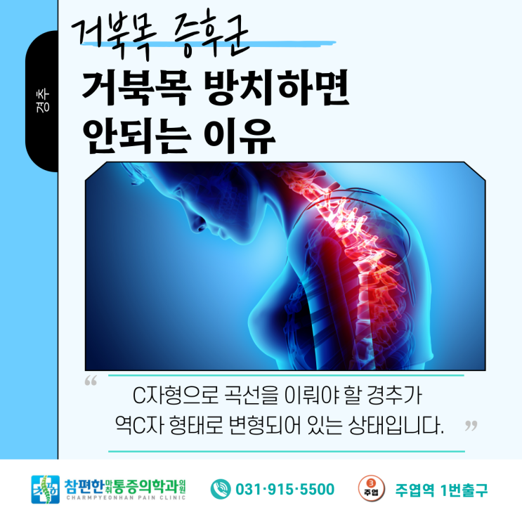  일산 정형외과에서 알려드리는 거북목 질환