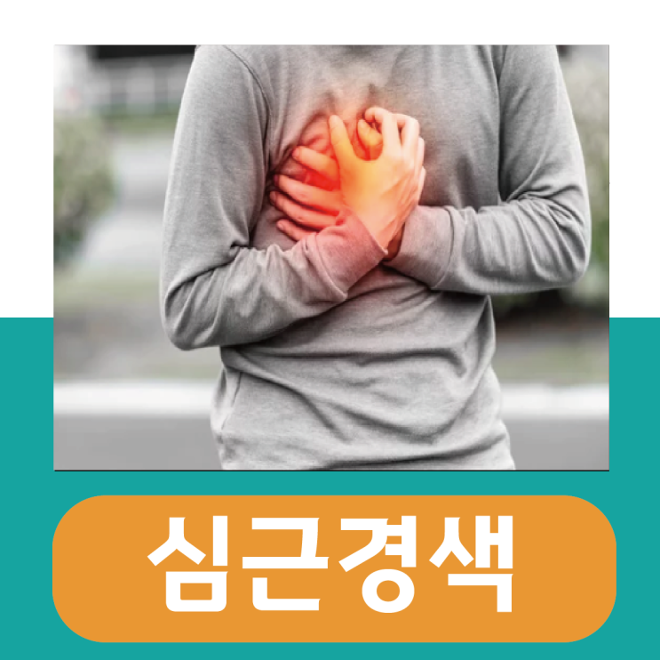  급성 심근경색 전조증상, 소화불량 인줄 알았는데