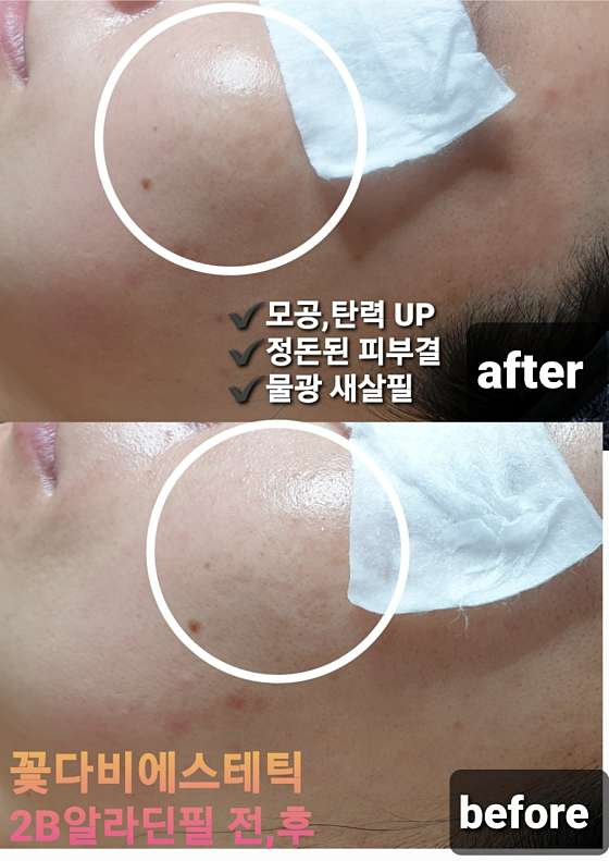꽃다비에스테틱 사진 2