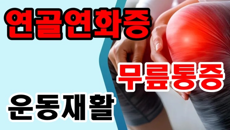  연골연화증으로 인한 무릎통증의 운동재활