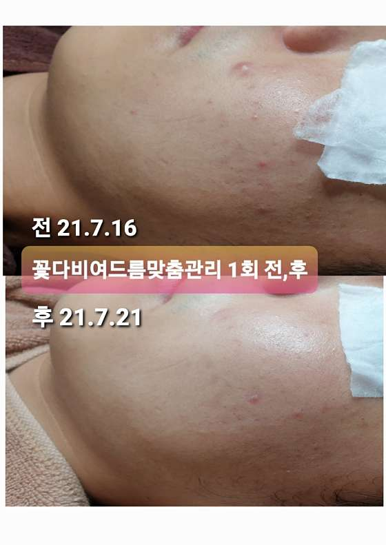 꽃다비에스테틱 사진 3