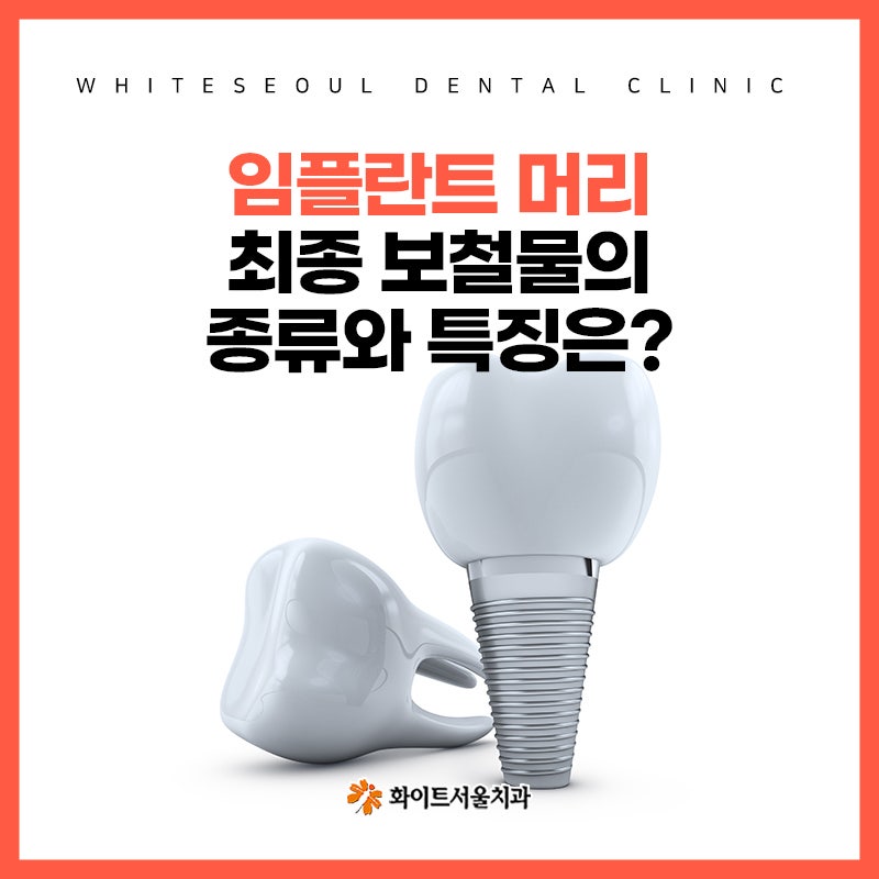 임플란트 머리, 최종 보철물의 종류와 특징은?