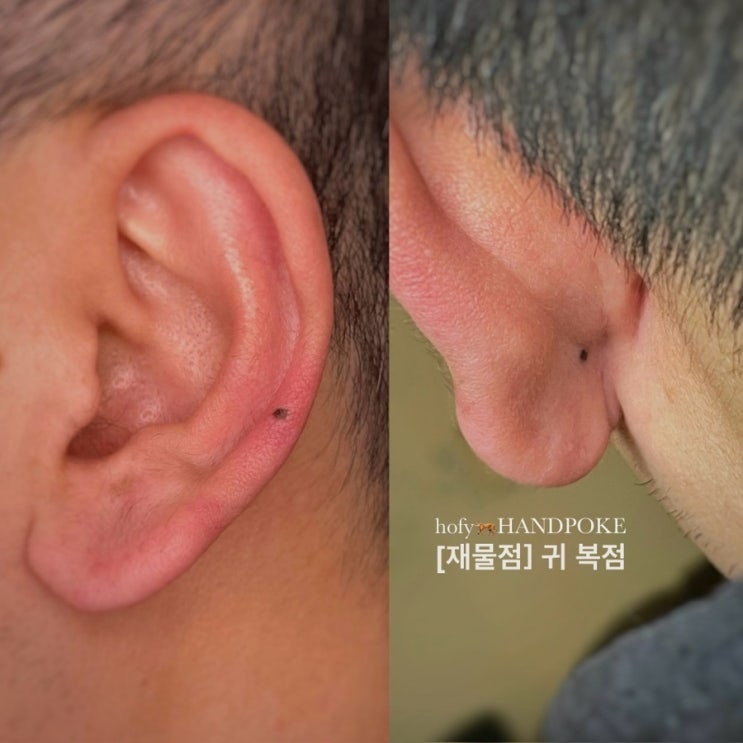  귀점과 귓볼점. 금전 개운법 [귀복점]