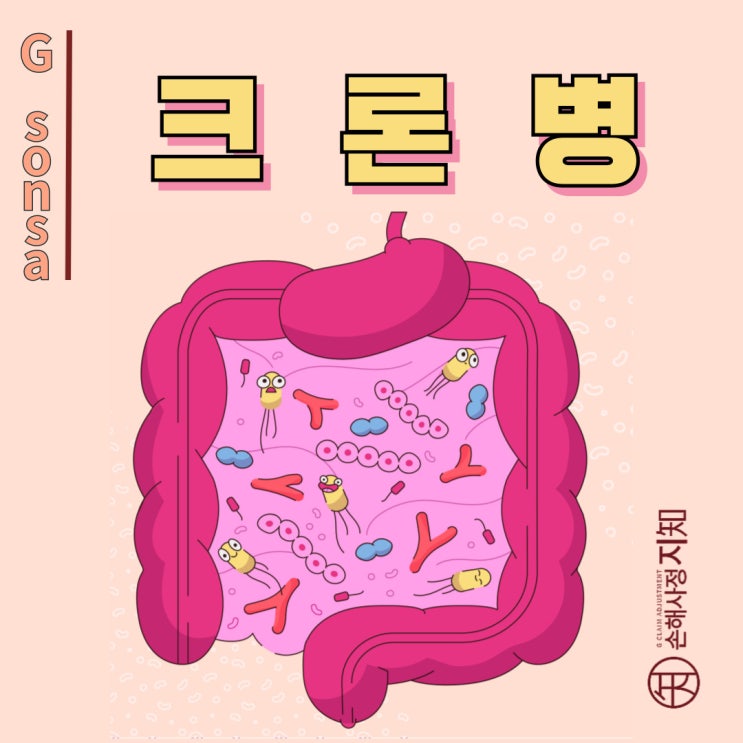  크론병 - 단순한 장염인 줄 알았는데 만성 염증성 장질환이었어요! - [질병정보, 1부]