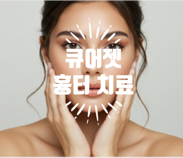  안산수원송도 여드름흉터 새살재생술 큐어젯 피부과 (의사작성, 의학정보전달)