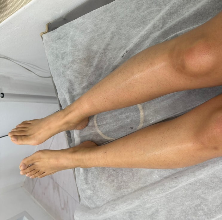  인천 부평 실력좋고 꼼꼼한 주블리왁싱에서 다리 왁싱 받아요