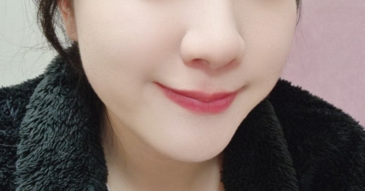  영등포피부과 신길동피부과 레디어스 앞볼꺼짐 효과 후기