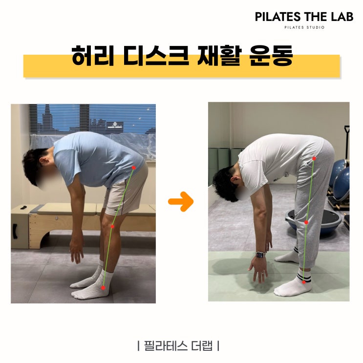  목동 필라테스 허리 디스크 재활 및 체형 교정 성공 후기