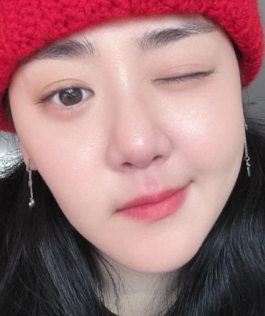  문근영 희귀병, 급성구획증후군이란? 원인과 치료법은?