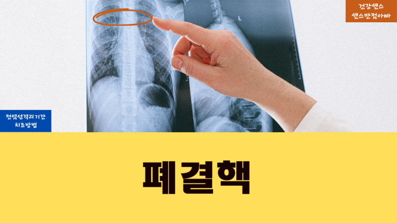 폐결핵 전염성 격리 기간 및 치료