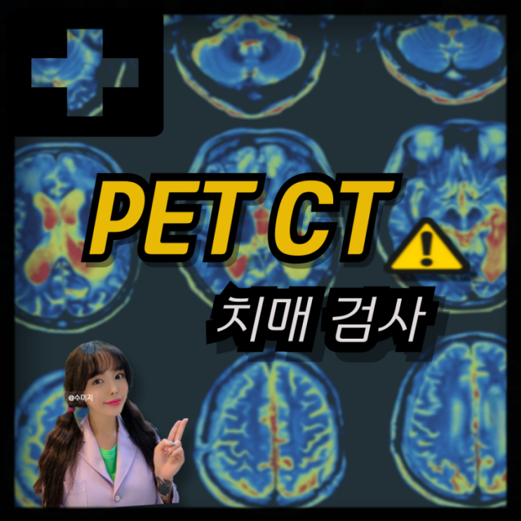  병원 치매검사 PET CT 검사 비용 금식 펫시티