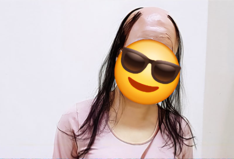 풍성한 머리결 관리 GS홈쇼핑 닥터그루트 프로바이탈 안티에이징 샴푸