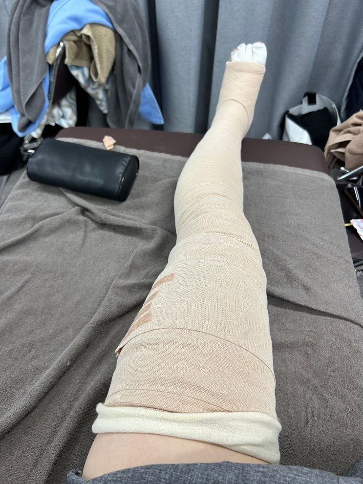  창원 림프부종 관리의 최신 연구 동향과 효과적인 치료 전략
