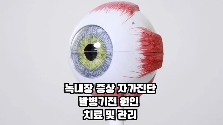  녹내장 증상 원인 테스트 발병기전 치료 관리8