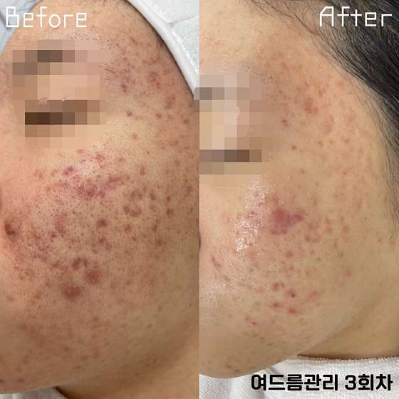 뷰티인플레이스 사진 3