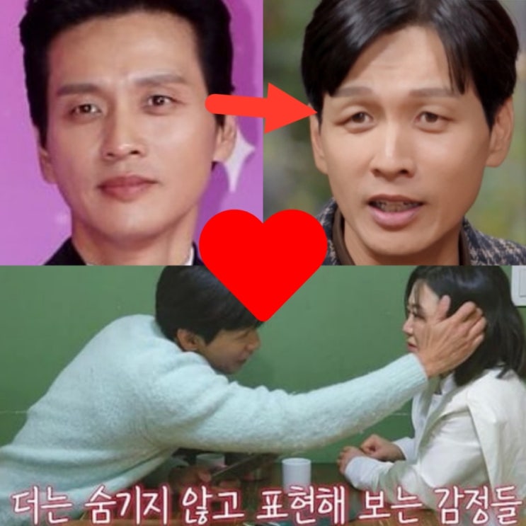 '<b>오만추</b> <b>김숙</b>' 51세 <b>구본승</b> 처진 눈, 필러 부작용이였다... 