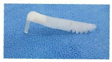  코끝과 콧대 비침 개선 - 자가늑연골, 진피이식 후기 [노즈랩의원]