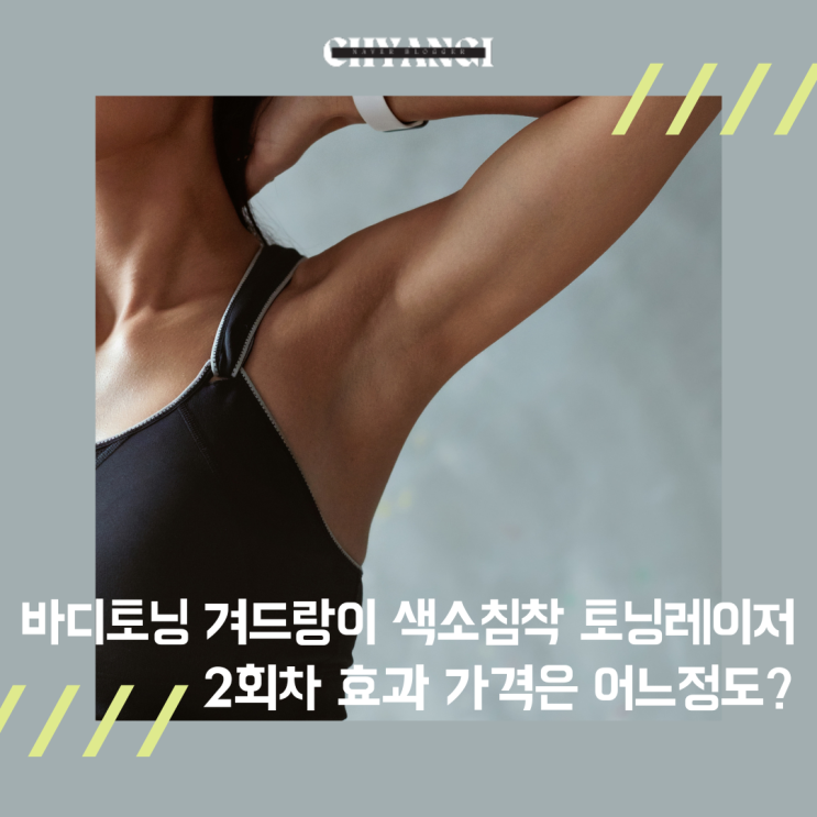  바디토닝 겨드랑이 색소침착 토닝레이저 2회차 효과 가격은 어느정도일까