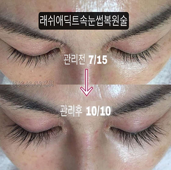 뷰티인플레이스 사진 6
