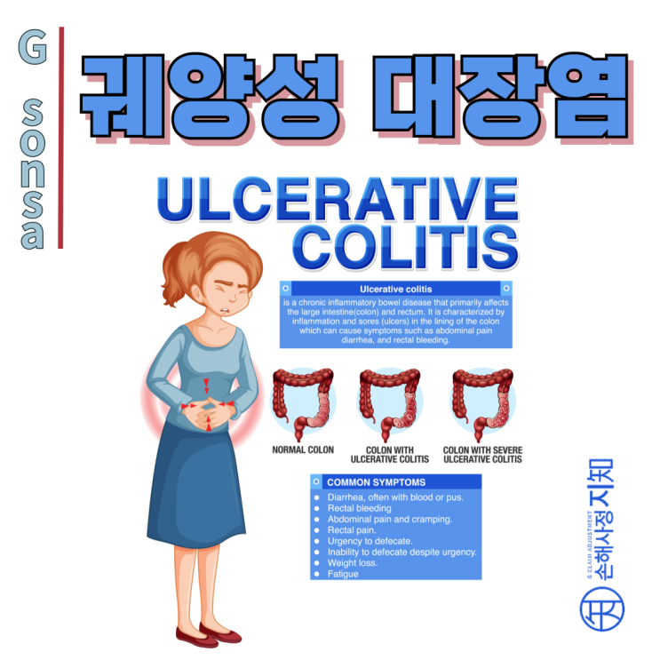  궤양성 대장염 - 혈변과 복통 대장이 보내는 위험 신호 - [질병정보, Why]