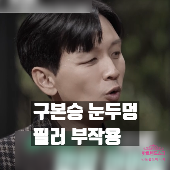  구본승, 눈두덩 처짐 원인 필러 부작용 고백! 재수술 안하는 이유 공개!