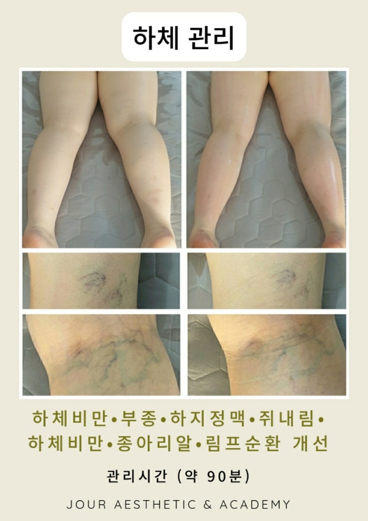  ️부산 하체관리️범일동 주르 에스테틱&아카데미