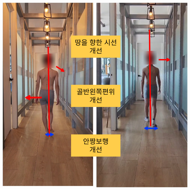  부산 사직동 초등 걸음걸이 교정, 레슨 10회 후 변화