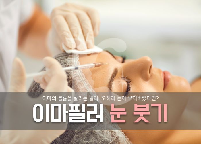  이마필러 눈붓기 작아진 눈 고민이라면 원인과 해결법은?