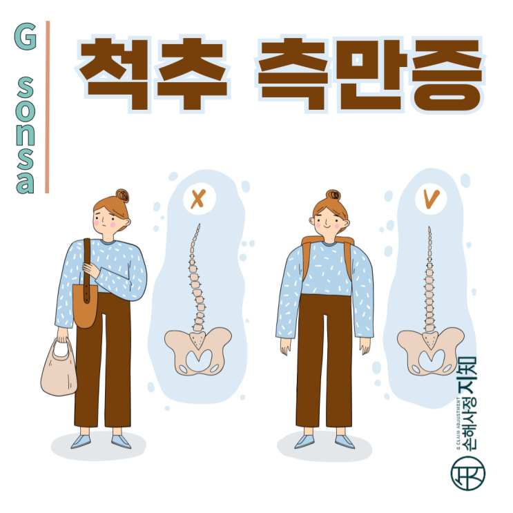  척추측만증, 골절 없이도 질병후유장해 보상받을 수 있다! - [척추질병, 2부]