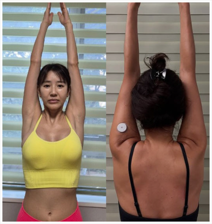 <b>윤현숙</b>, <b>1형 당뇨 투병</b>과 어깨 기형 고백… “삶의 질이... 