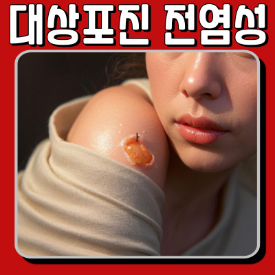 대상포진 전염성! 가족, 아이들에게 옮을까? 완벽 정리