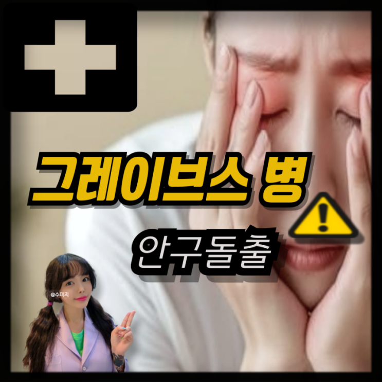  그레이브스병 눈 안구돌출 증상 갑상선 안병증 치료 안와감압술