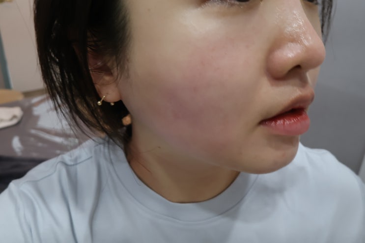  대치동 피부관리 클로이 에스테틱 방문 후기! 수분충전으로 꽉 채우기
