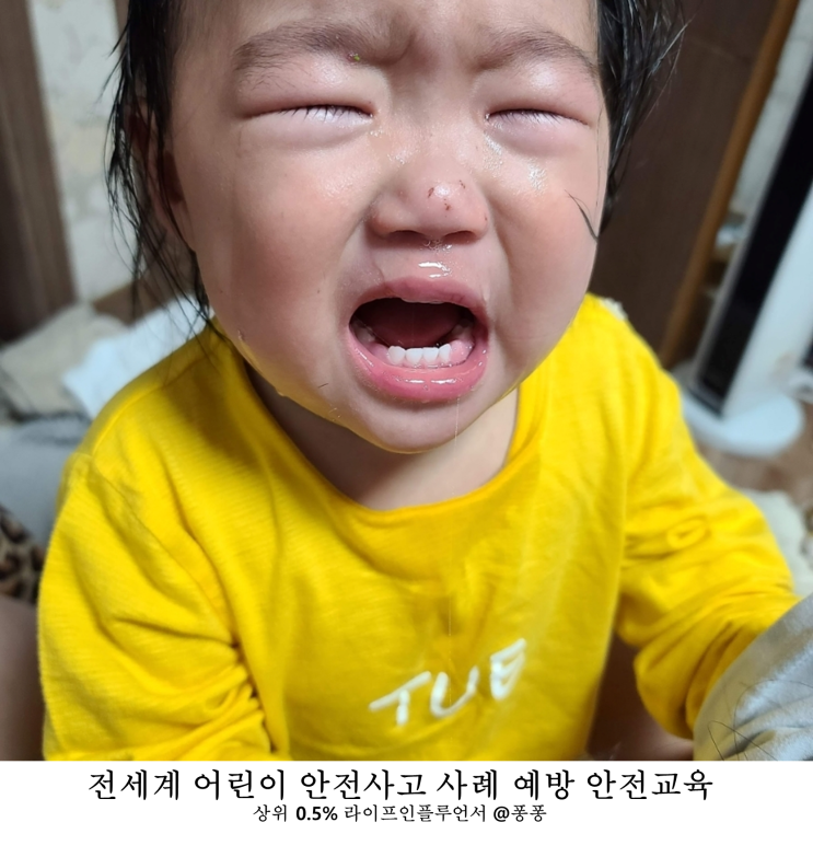  유아 어린이 안전사고 실제 사례 사고 예방 안전교육 (시청 주의)