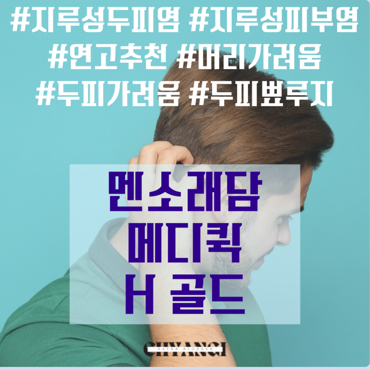  두피 가려움증 머리 가려움 간지러움 병원치료 없이 극복한 비법은?