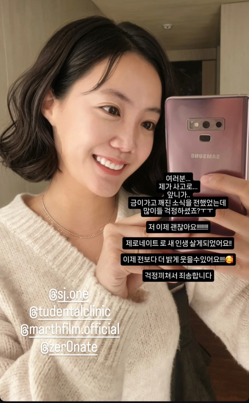 "코 재수술+새 이빨" 고은아, 물오른 미모에도 과거 얼굴 그리워?