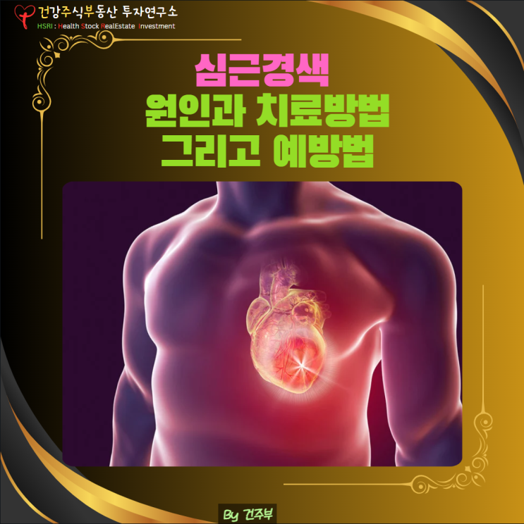  심근경색 원인과 치료법 총정리! 증상부터 예방법까지 알아보기