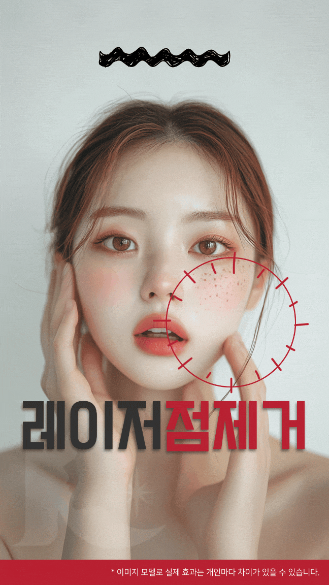  광주점제거 손상없이 점빼기 점잘빼는곳 포인트는