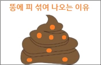  똥에 피 섞여 나오는 이유