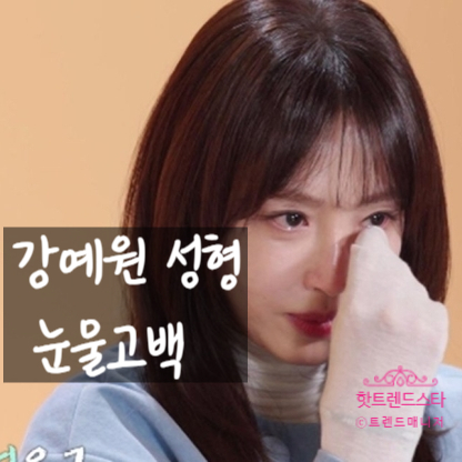  강예원, 얼굴 변신 뒤 눈물 고백! 앞트임 복원 진실과 숨겨진 사연