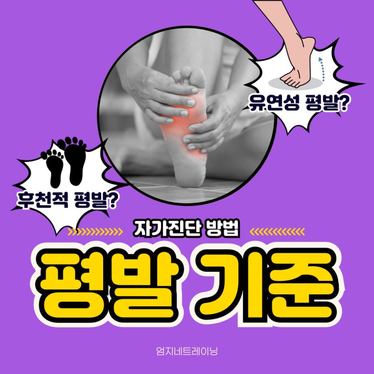  정발산pt 평발 기준과 자가진단 방법