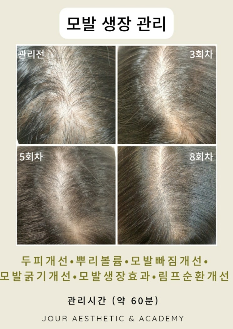 ️부산탈모관리️범일동 주르 에스테틱