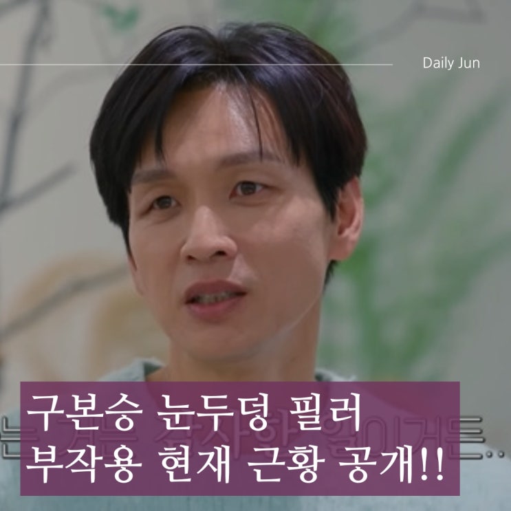  구본승 눈두덩 필러 부작용? 결국 제거 후 달라진 근황 공개!